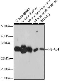 Western blot - H2-Ab1 antibody (A18658)