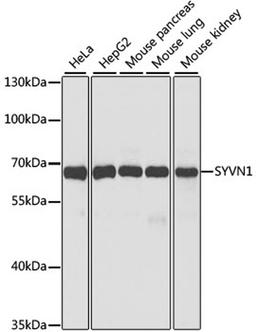 Western blot - SYVN1 antibody (A2605)