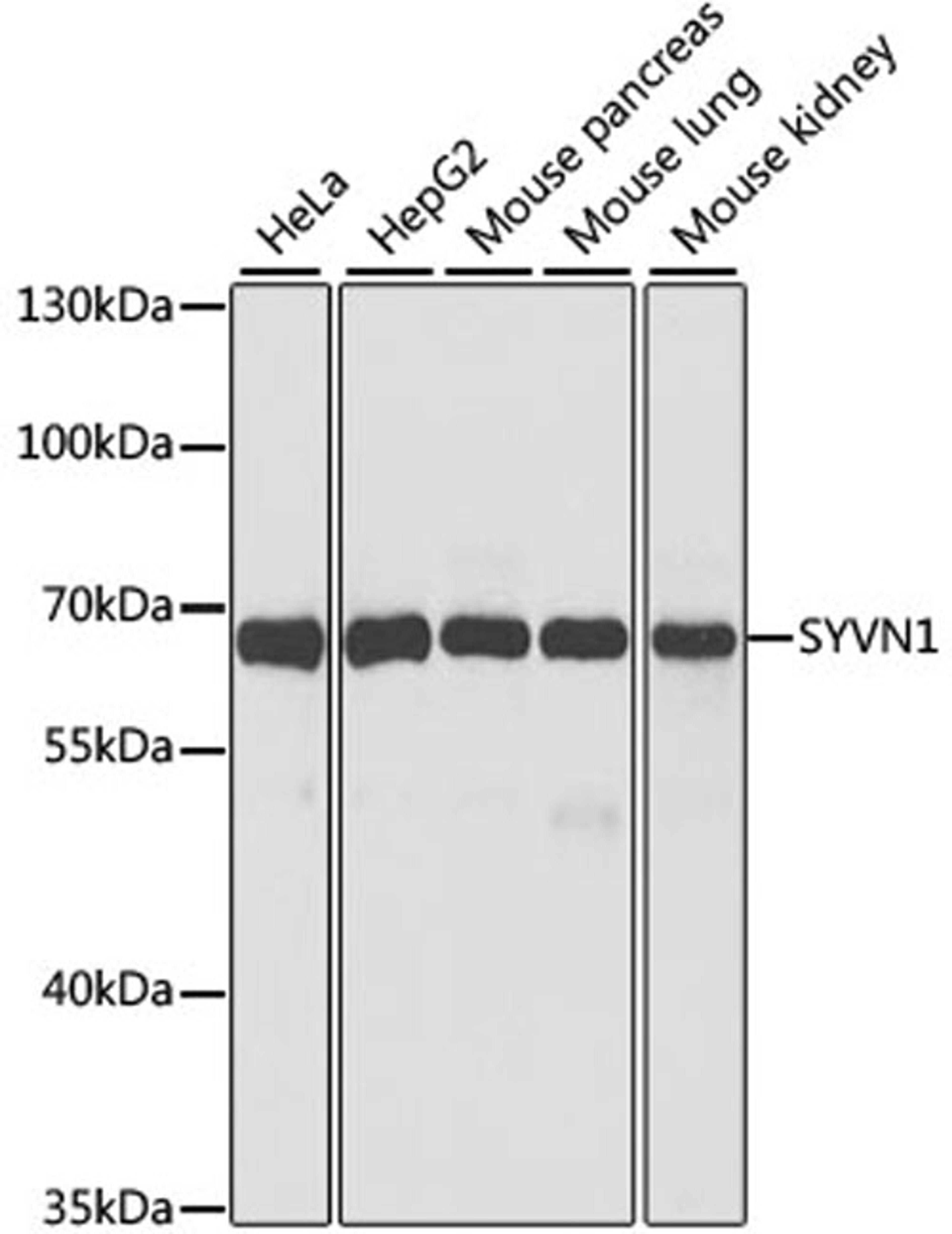 Western blot - SYVN1 antibody (A2605)