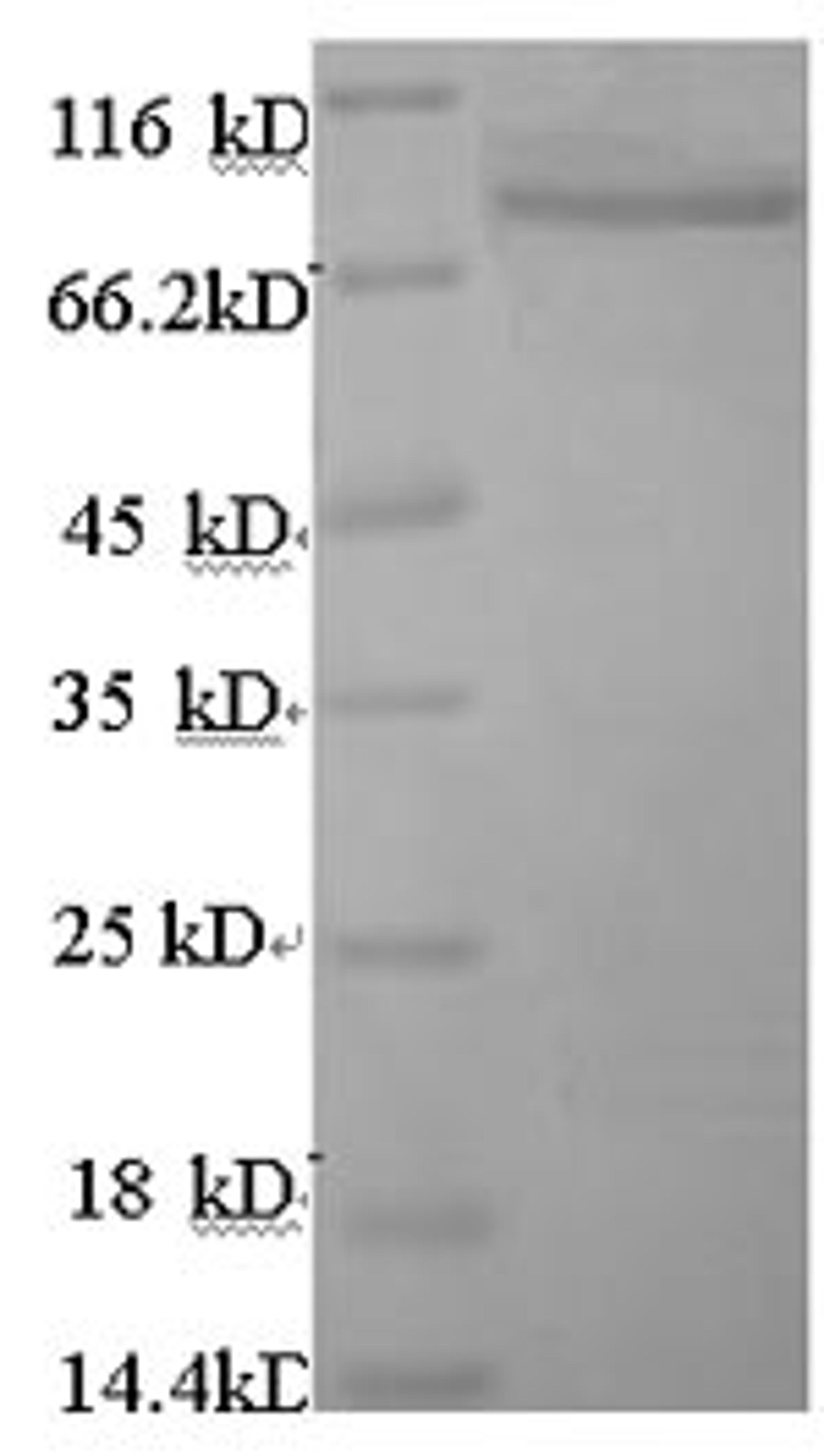(Tris-Glycine gel) Discontinuous SDS-PAGE (reduced) with 5% enrichment gel and 15% separation gel.