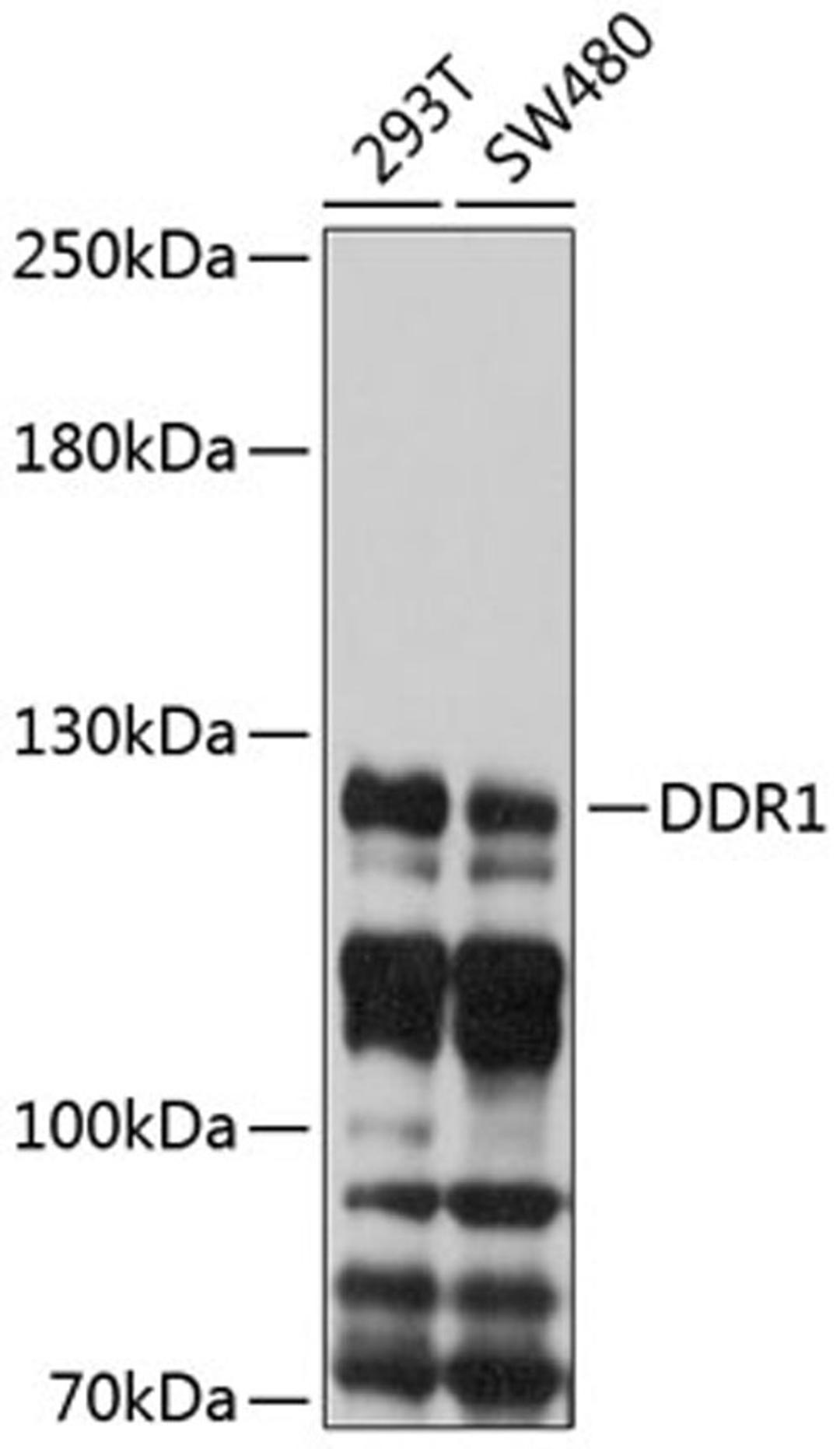 Western blot - DDR1 antibody (A10487)