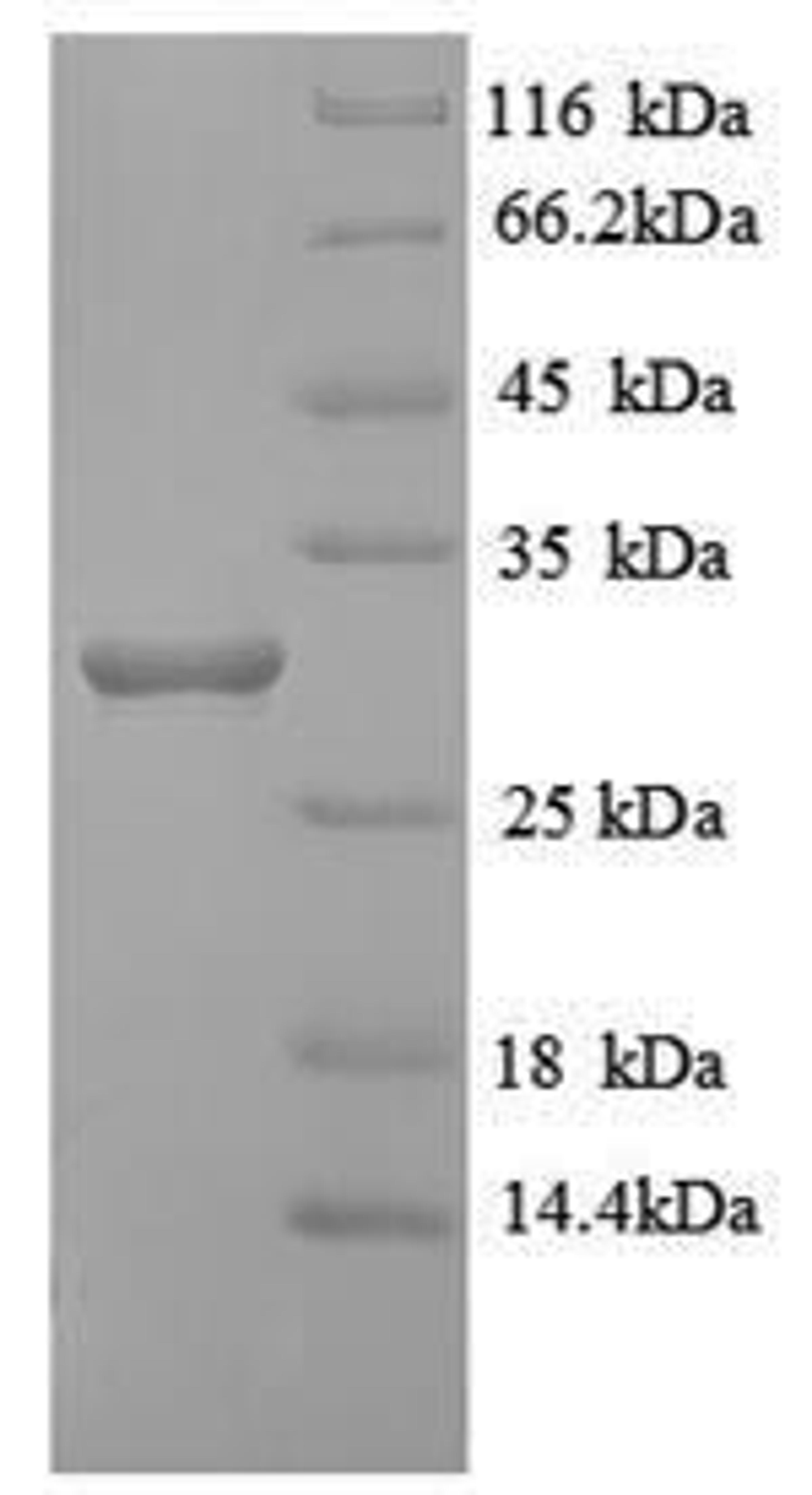 (Tris-Glycine gel) Discontinuous SDS-PAGE (reduced) with 5% enrichment gel and 15% separation gel.