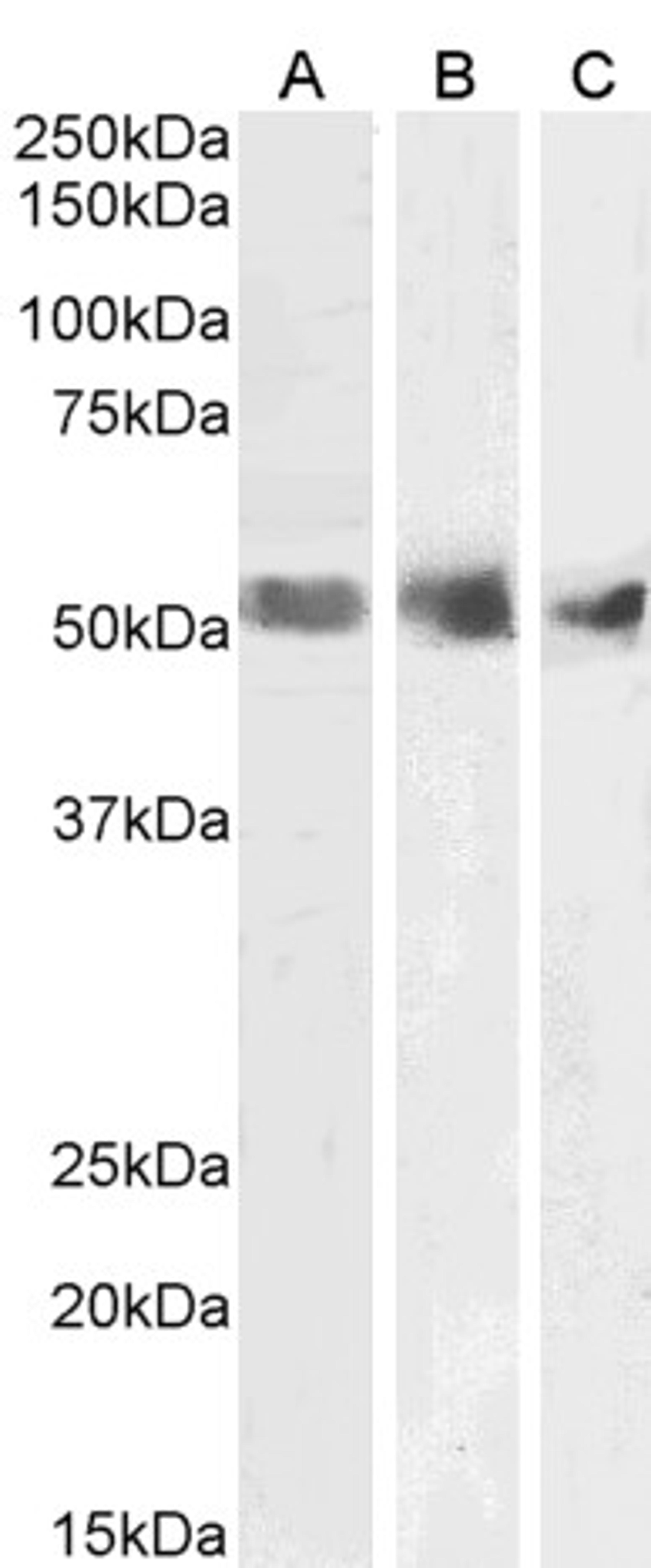 46-601 (1ug/ml) staining of Human Spleen (A), Kidney (B) and Testis (C) lysates (35ug protein in RIPA buffer). Primary incubation was 1 hour. Detected by chemiluminescence.