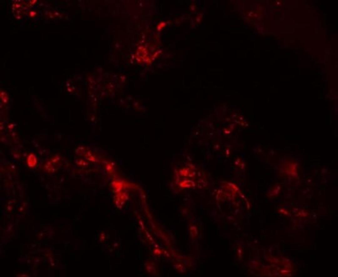 Immunocytochemistry/Immunofluorescence: TM4SF1/L6 Antibody [NBP1-76549] - Immunofluorescence of TM4SF1 in human lung tissue with TM4SF1 antibody at 20 ug/mL.