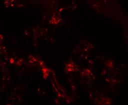 Immunocytochemistry/Immunofluorescence: TM4SF1/L6 Antibody [NBP1-76549] - Immunofluorescence of TM4SF1 in human lung tissue with TM4SF1 antibody at 20 ug/mL.