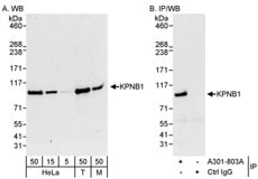 Detection of human and mouse KPNB1 by western blot (h&m) and immunoprecipitation (h).