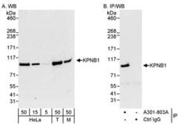 Detection of human and mouse KPNB1 by western blot (h&m) and immunoprecipitation (h).