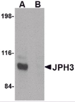 Western blot analysis of JPH3 in Daudi cell lysate with JPH3 antibody at 1 &#956;g/mL in (A) the absence and (B) the presence of blocking peptide.