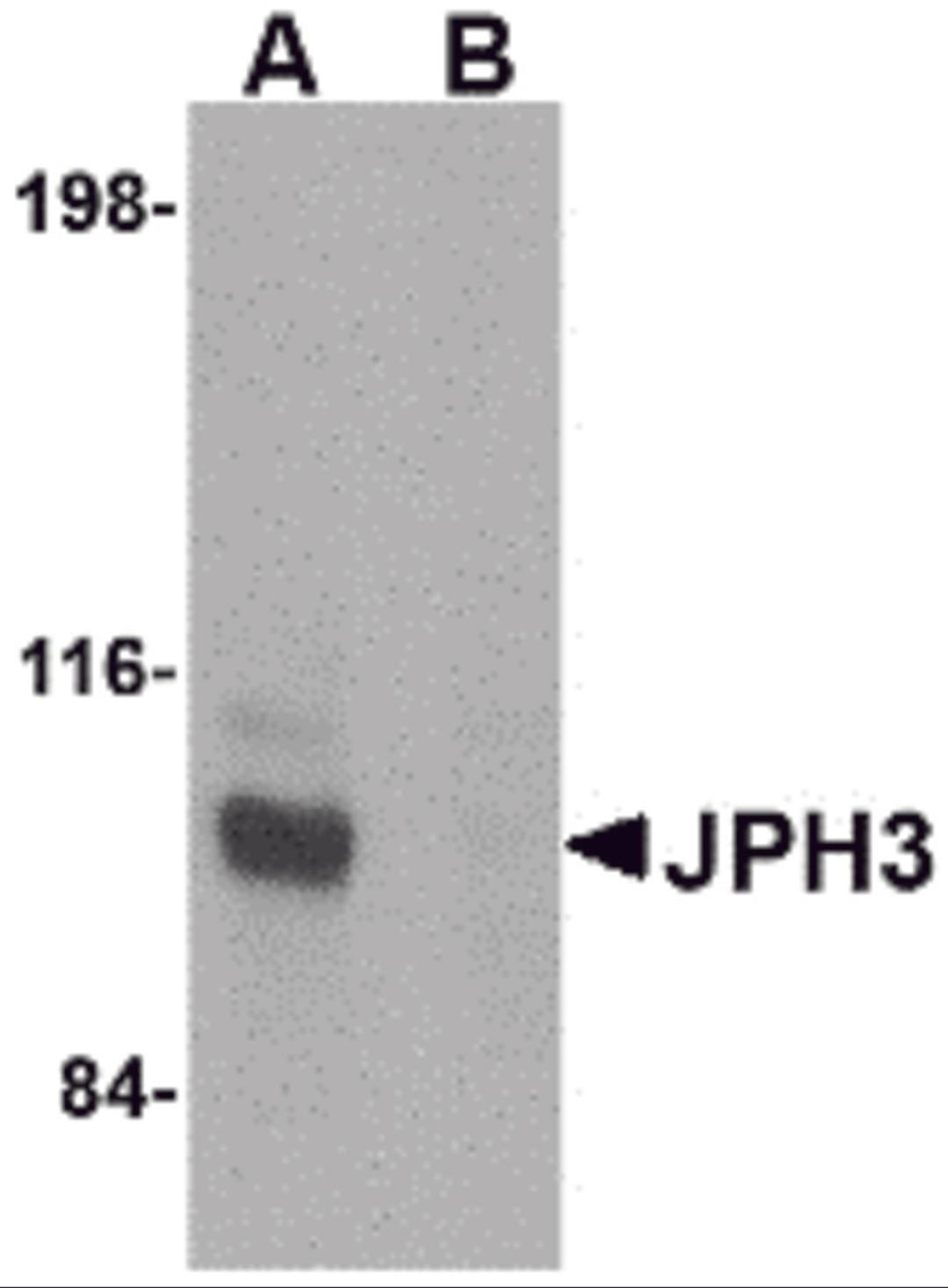 Western blot analysis of JPH3 in Daudi cell lysate with JPH3 antibody at 1 μg/mL in (A) the absence and (B) the presence of blocking peptide.