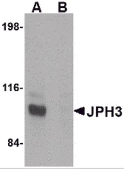 Western blot analysis of JPH3 in Daudi cell lysate with JPH3 antibody at 1 μg/mL in (A) the absence and (B) the presence of blocking peptide.