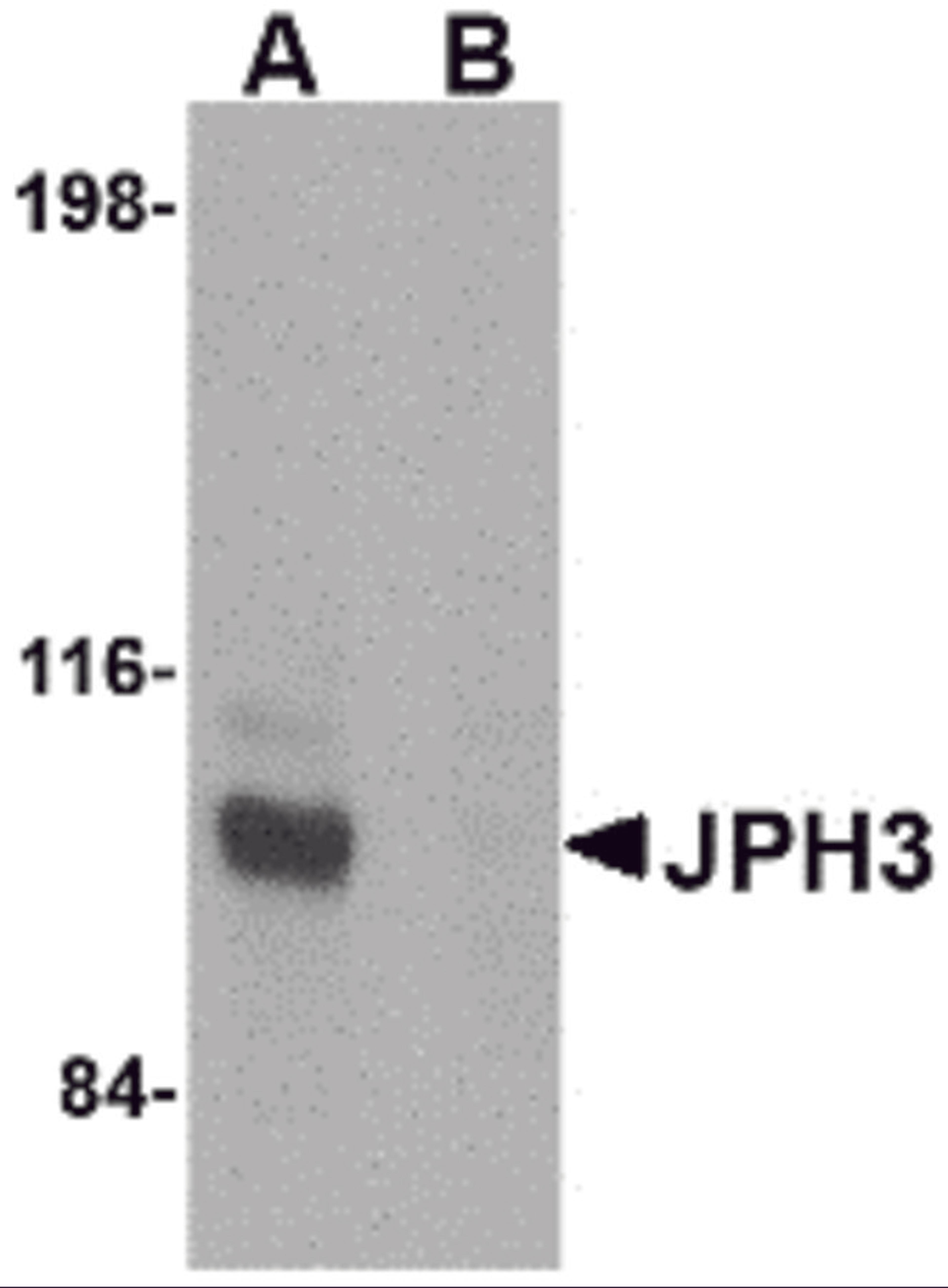 Western blot analysis of JPH3 in Daudi cell lysate with JPH3 antibody at 1 μg/mL in (A) the absence and (B) the presence of blocking peptide.