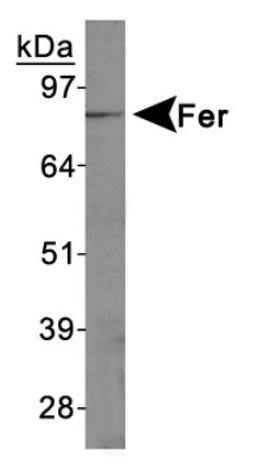 Western Blot: FER Antibody [NBP1-20089] - Jurkat cell lysates.