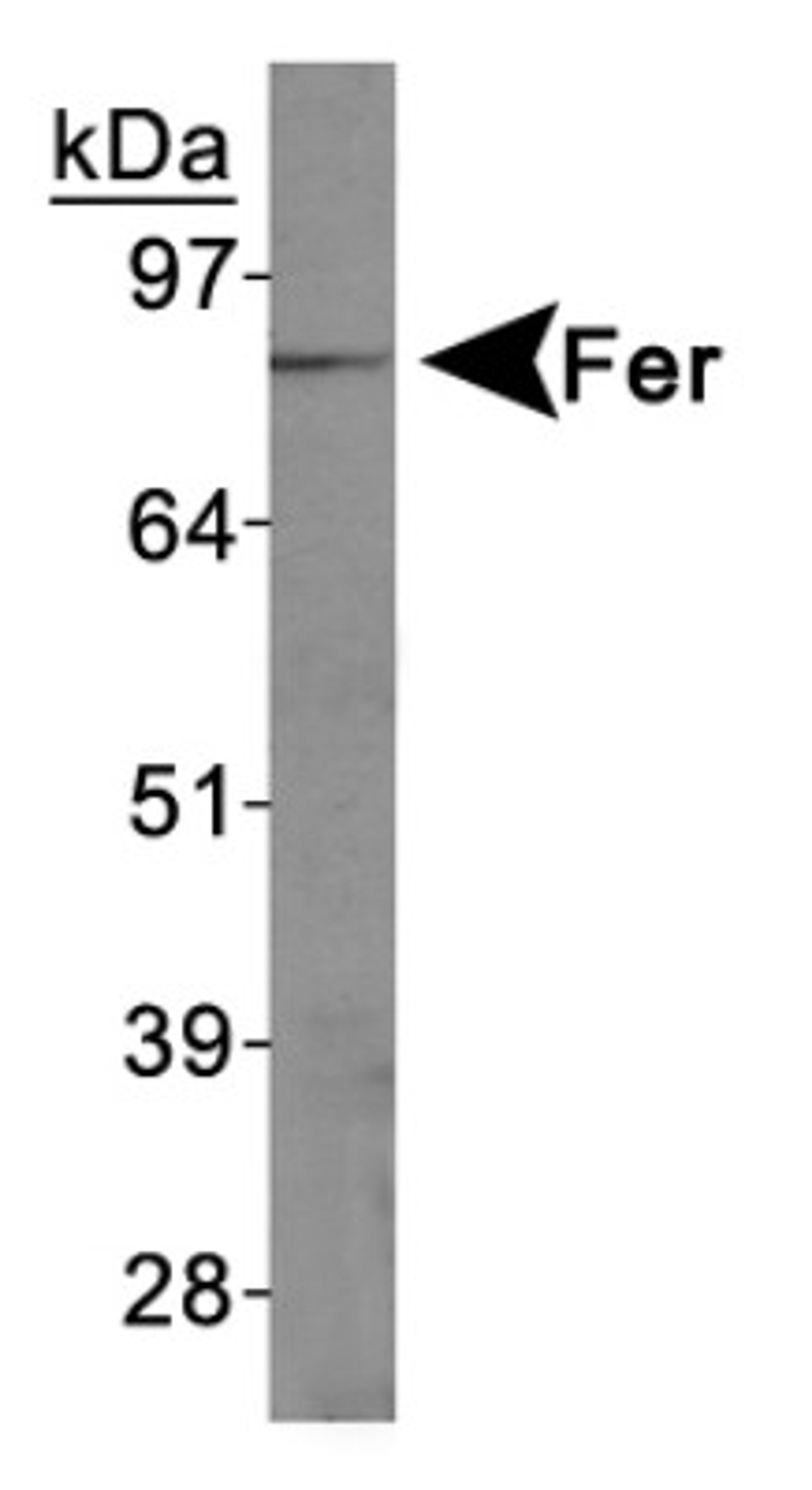 Western Blot: FER Antibody [NBP1-20089] - Jurkat cell lysates.