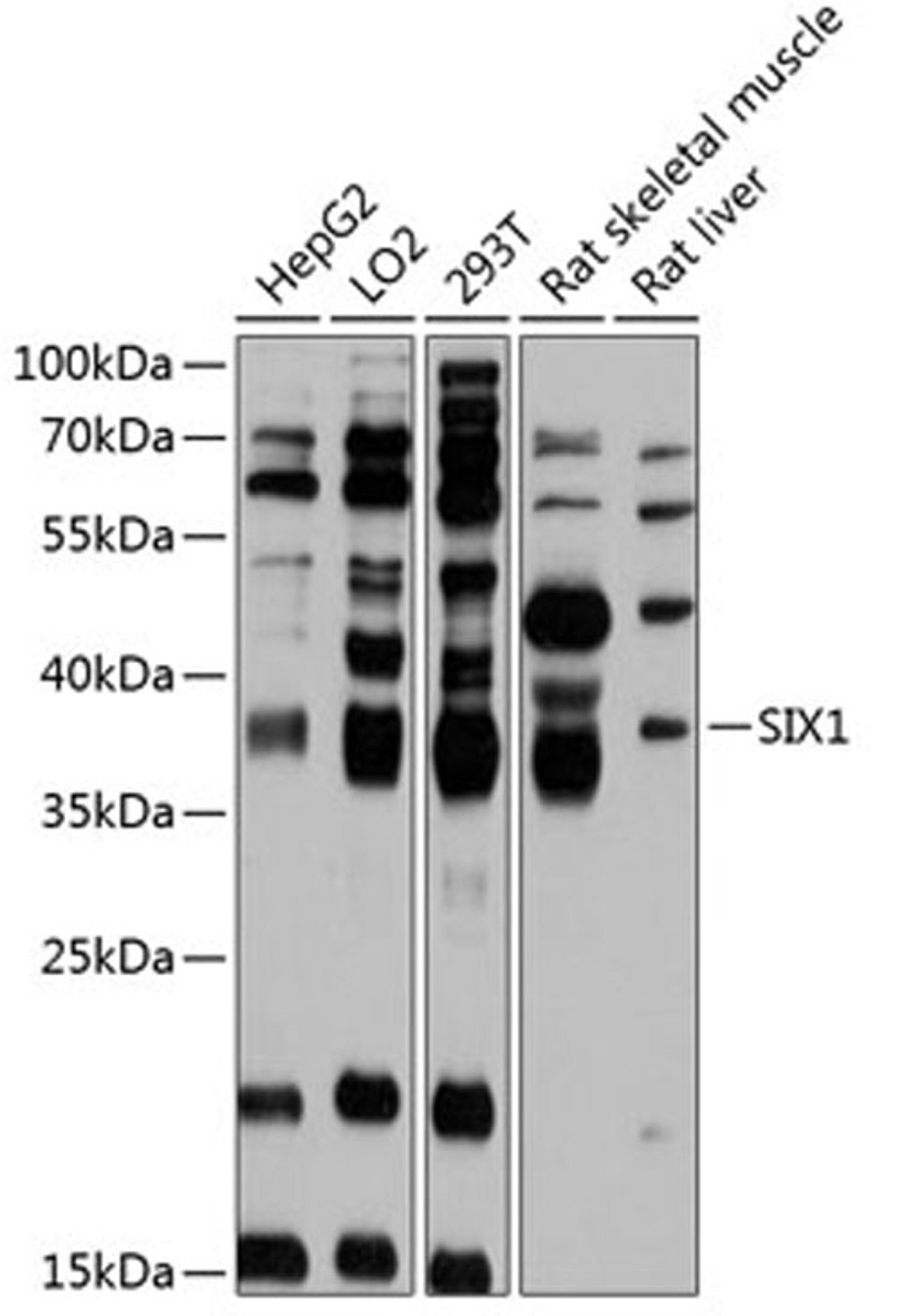 Western blot - SIX1 antibody (A11954)