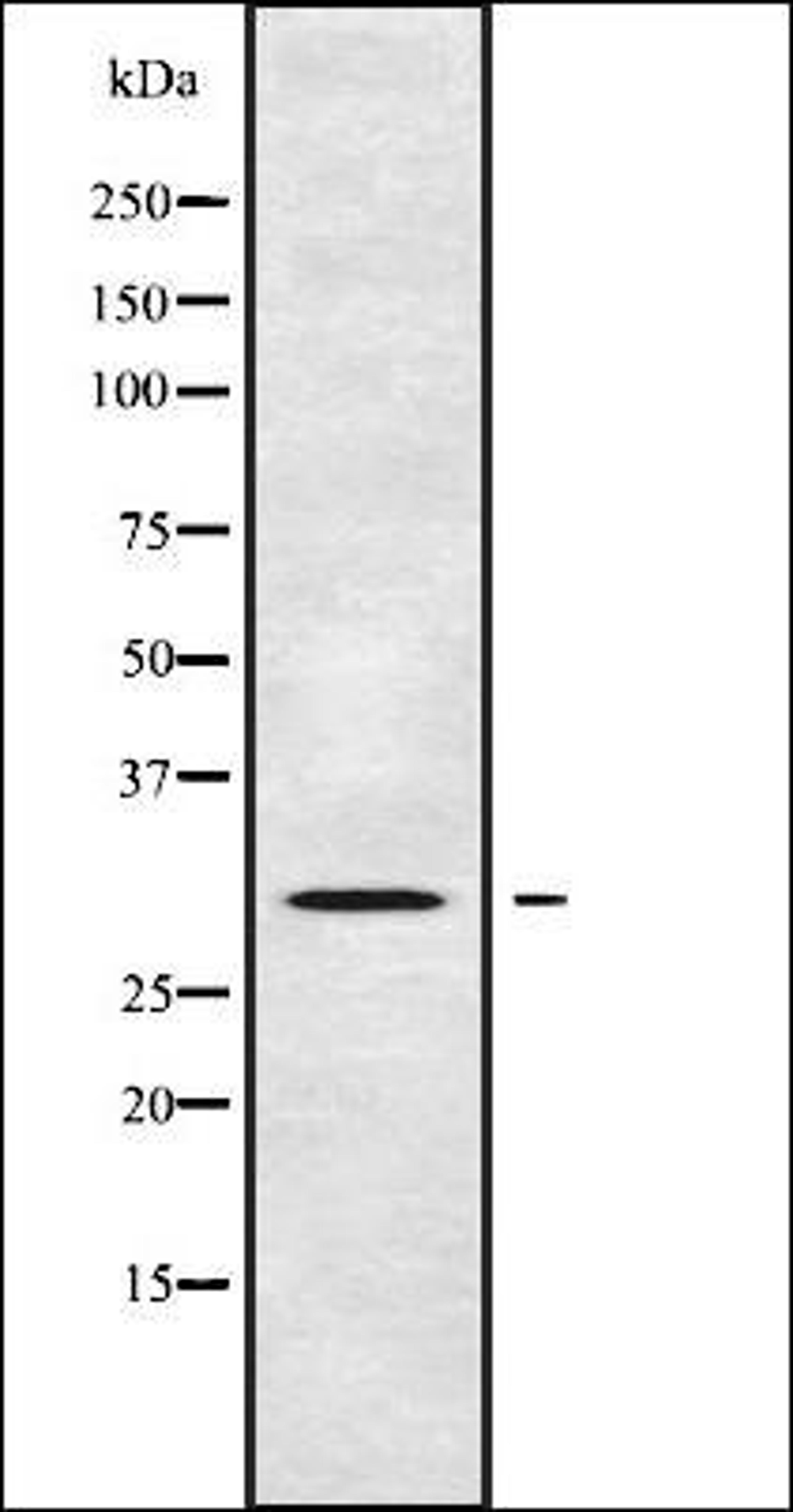 Western blot analysis of 293 whole cell lysates using AQP8 antibody