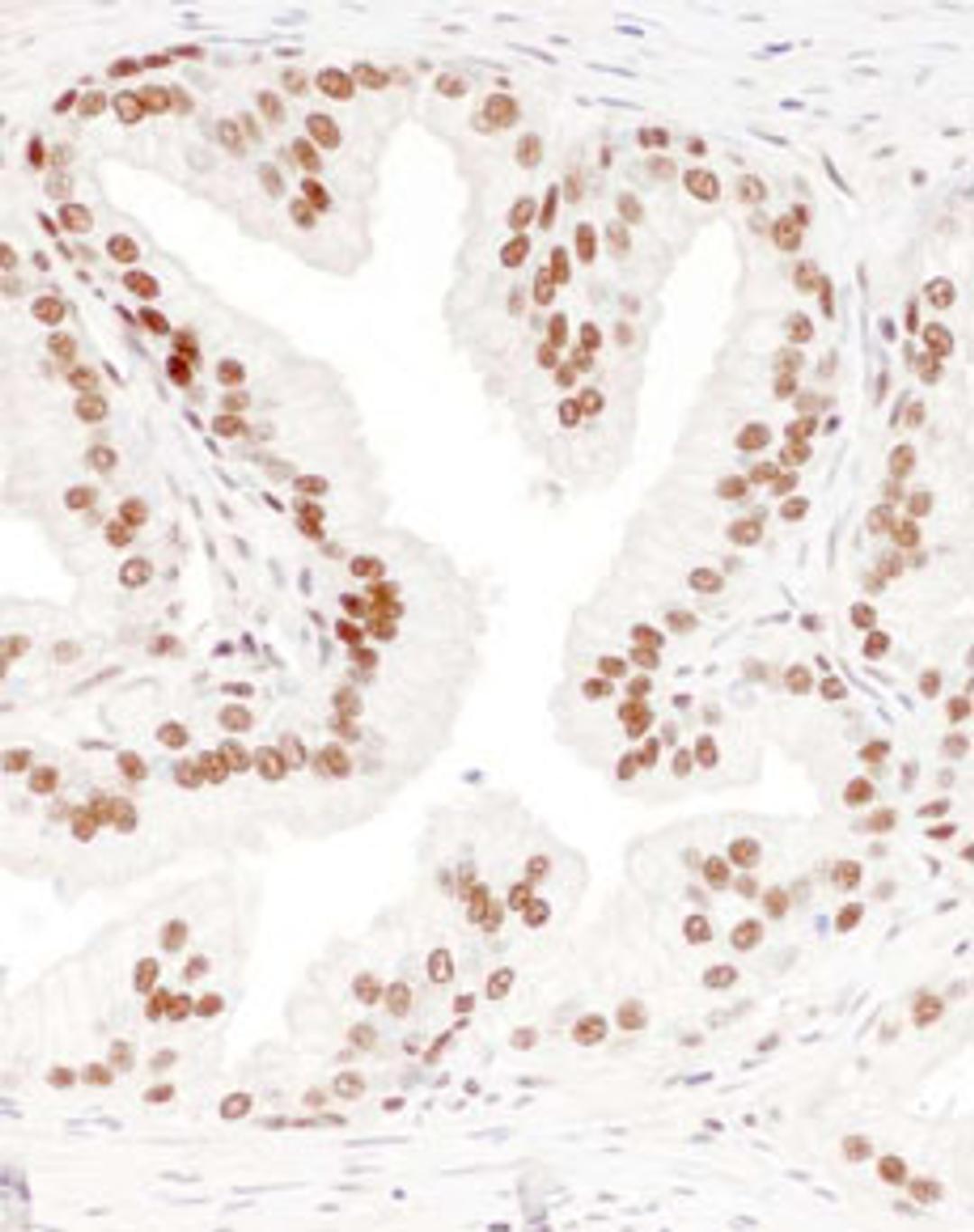 Detection of human DBC1/p30 by immunohistochemistry.