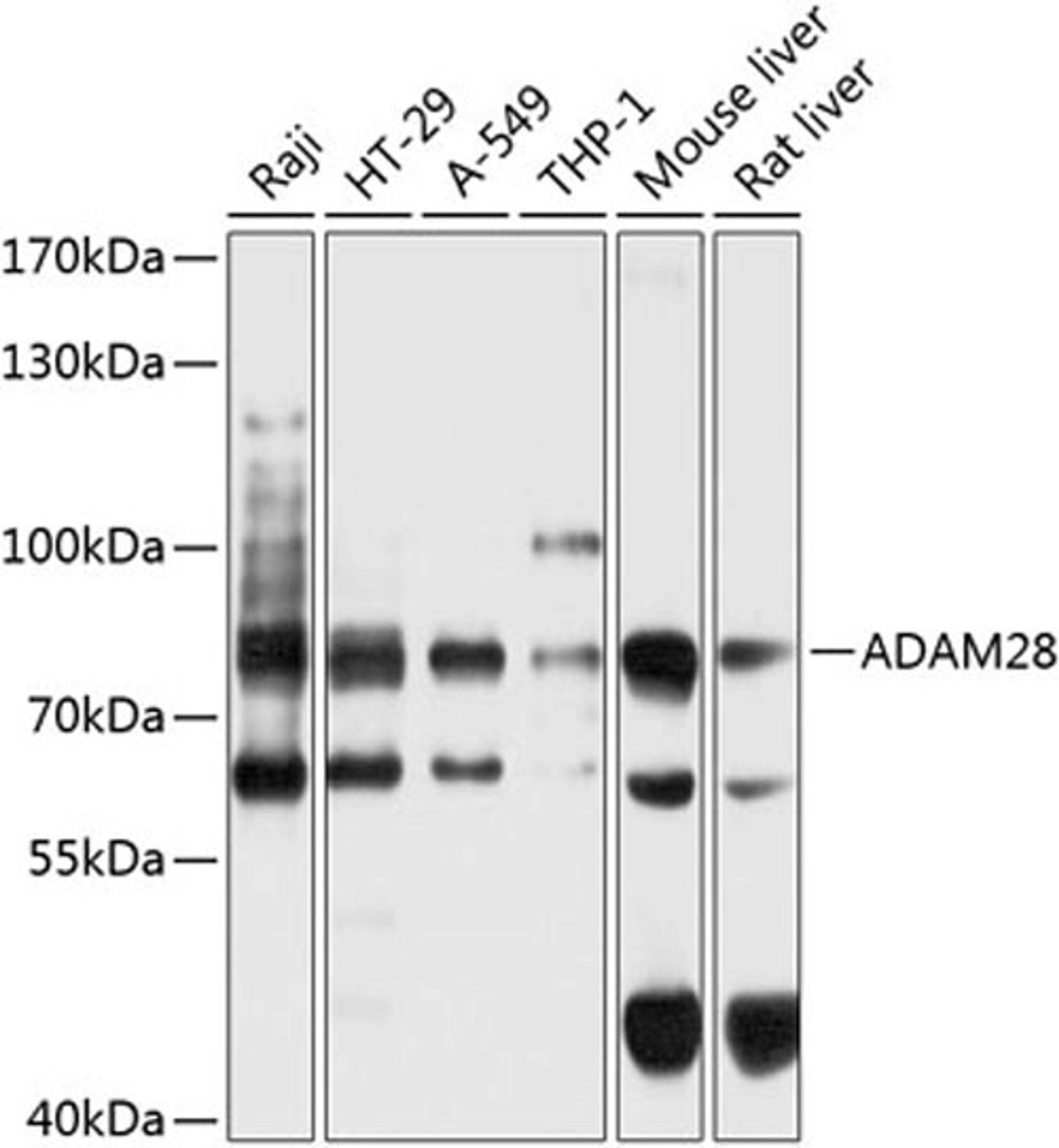 Western blot - ADAM28 antibody (A9512)