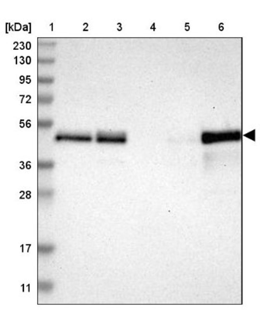 Western Blot: TSC22D4 Antibody [NBP1-80688] - Lane 1: Marker [kDa] 230, 130, 95, 72, 56, 36, 28, 17, 11<br/>Lane 2: Human cell line RT-4<br/>Lane 3: Human cell line U-251MG sp<br/>Lane 4: Human plasma (IgG/HSA depleted)<br/>Lane 5: Human liver tissue<br/>Lane 6: Human tonsil tissue