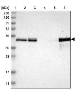 Western Blot: TSC22D4 Antibody [NBP1-80688] - Lane 1: Marker [kDa] 230, 130, 95, 72, 56, 36, 28, 17, 11<br/>Lane 2: Human cell line RT-4<br/>Lane 3: Human cell line U-251MG sp<br/>Lane 4: Human plasma (IgG/HSA depleted)<br/>Lane 5: Human liver tissue<br/>Lane 6: Human tonsil tissue