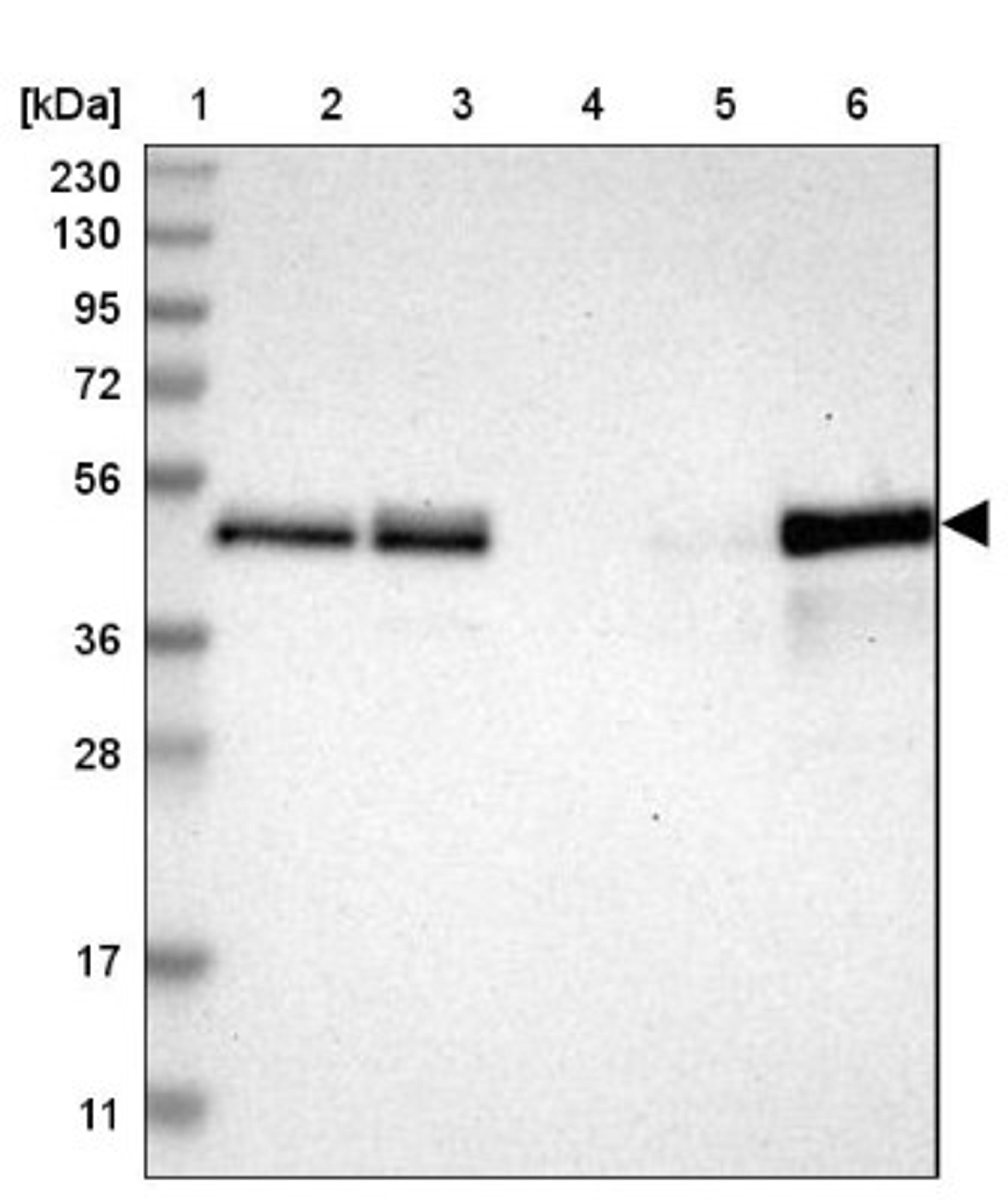 Western Blot: TSC22D4 Antibody [NBP1-80688] - Lane 1: Marker [kDa] 230, 130, 95, 72, 56, 36, 28, 17, 11<br/>Lane 2: Human cell line RT-4<br/>Lane 3: Human cell line U-251MG sp<br/>Lane 4: Human plasma (IgG/HSA depleted)<br/>Lane 5: Human liver tissue<br/>Lane 6: Human tonsil tissue