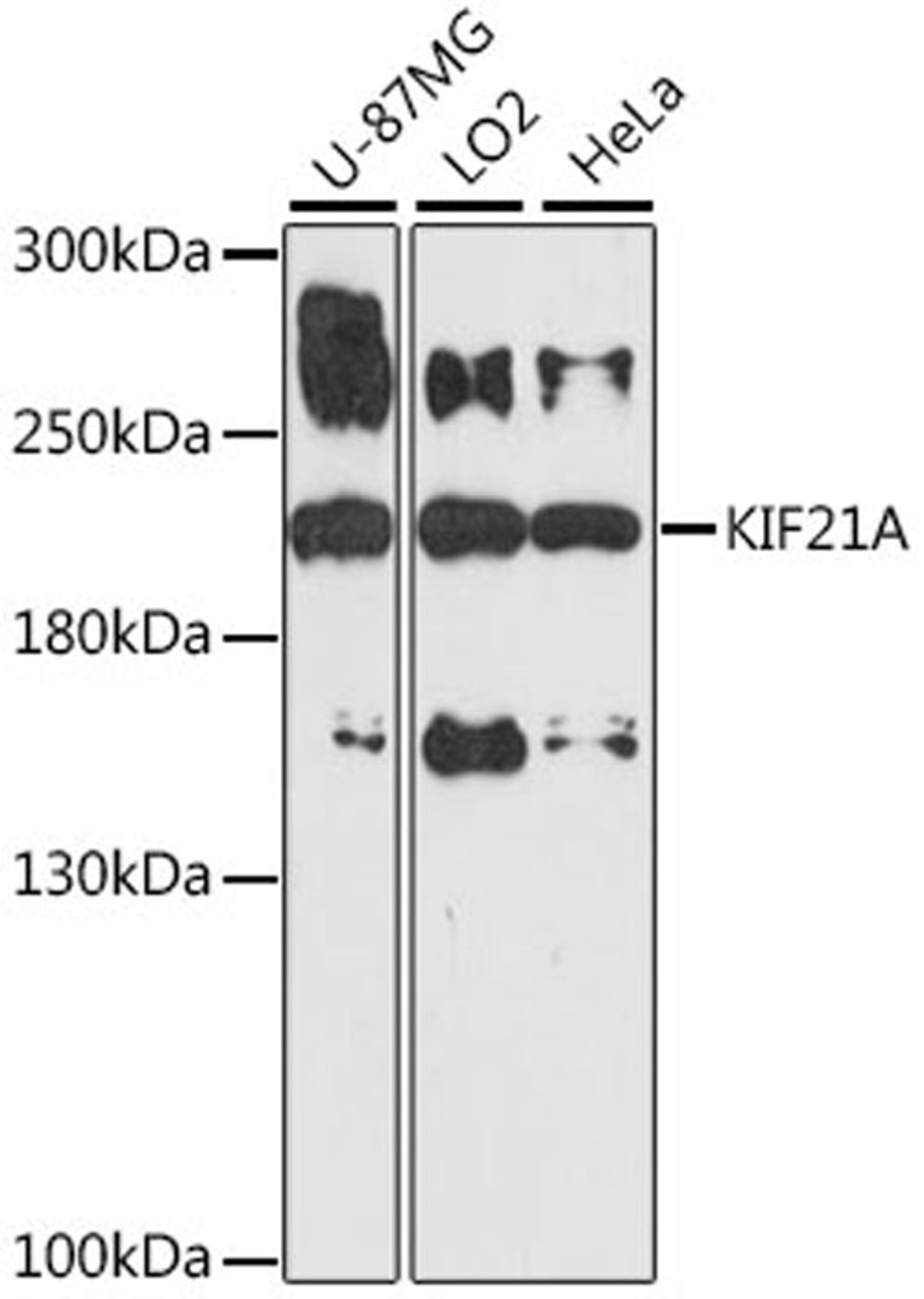 Western blot - KIF21A antibody (A16548)