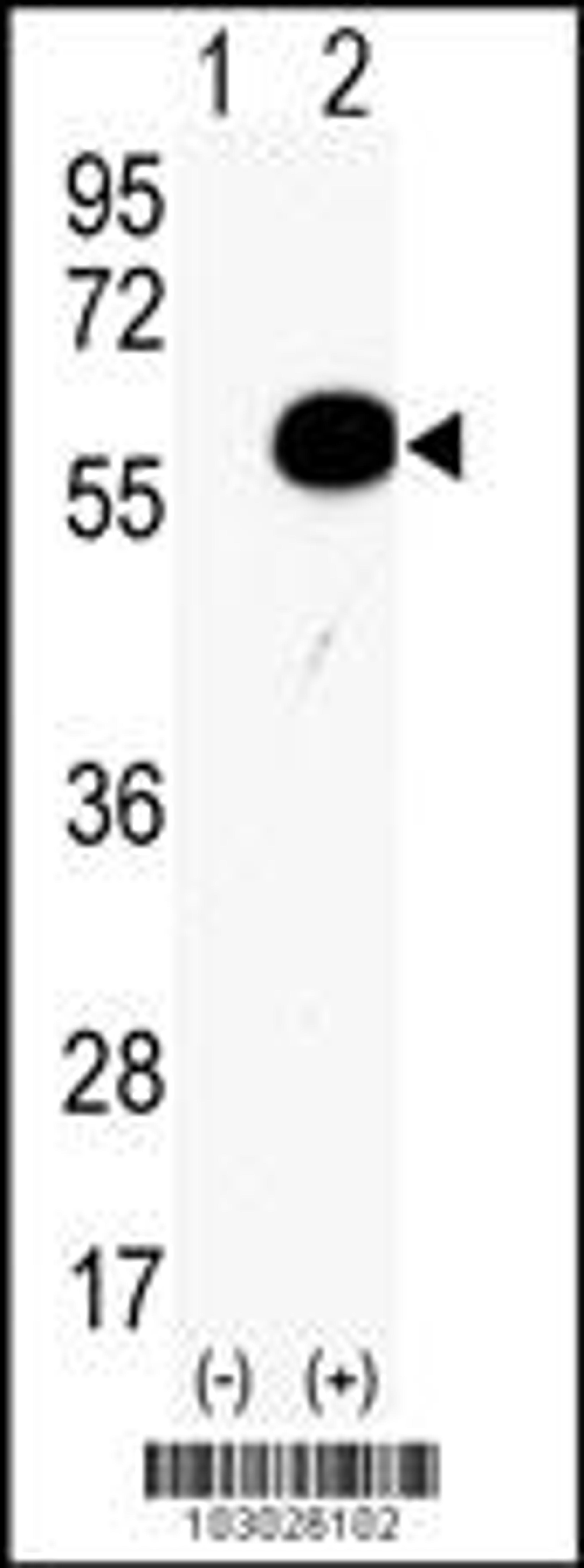 Western blot analysis of AKT2 using rabbit polyclonal AKT2 Antibody using 293 cell lysates (2 ug/lane) either nontransfected (Lane 1) or transiently transfected with the AKT2 gene (Lane 2).