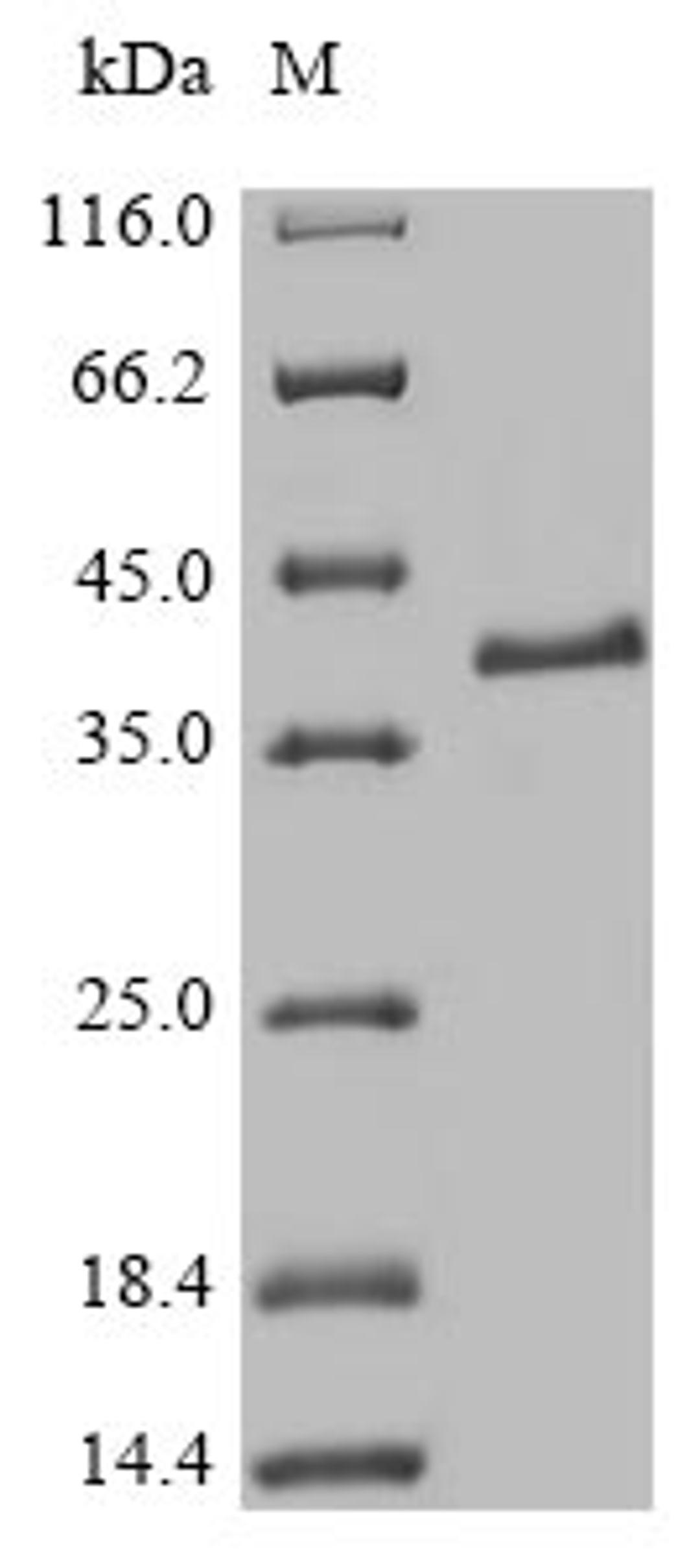 (Tris-Glycine gel) Discontinuous SDS-PAGE (reduced) with 5% enrichment gel and 15% separation gel.