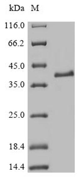 (Tris-Glycine gel) Discontinuous SDS-PAGE (reduced) with 5% enrichment gel and 15% separation gel.