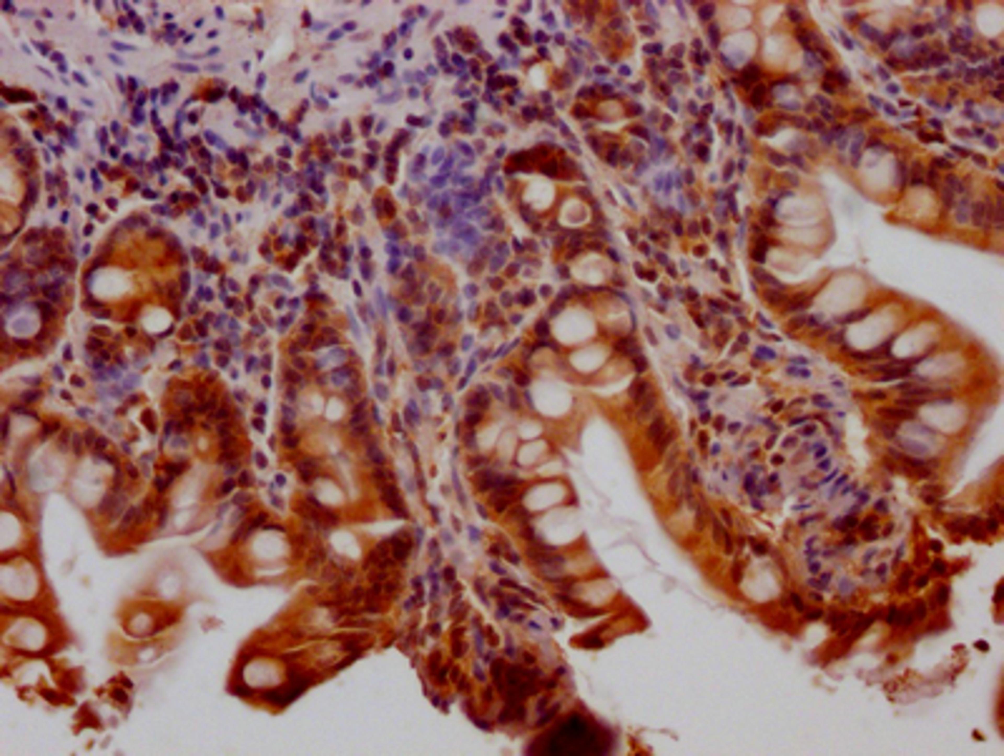 IHC image of CSB-RA802195A0HU diluted at 1:100 and staining in paraffin-embedded human small intestine tissue performed on a Leica BondTM system. After dewaxing and hydration, antigen retrieval was mediated by high pressure in a citrate buffer (pH 6.0). Section was blocked with 10% normal goat serum 30min at RT. Then primary antibody (1% BSA) was incubated at 4℃ overnight. The primary is detected by a Goat anti-rabbit IgG polymer labeled by HRP and visualized using 0.05% DAB.