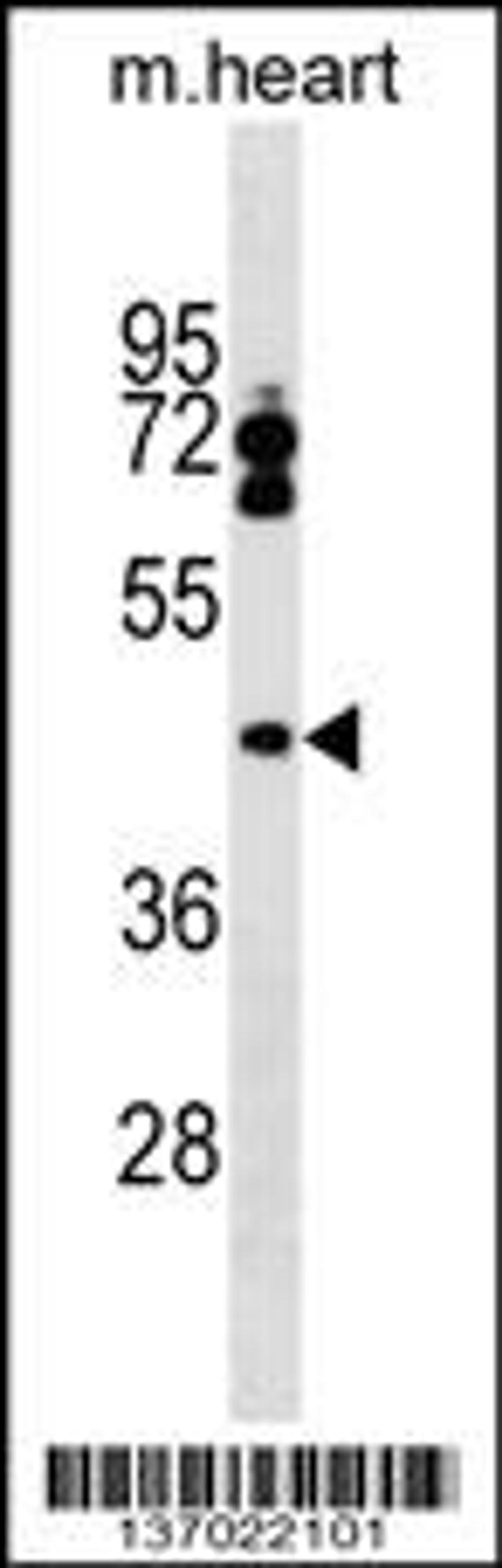 Western blot analysis in mouse heart tissue lysates (35ug/lane).