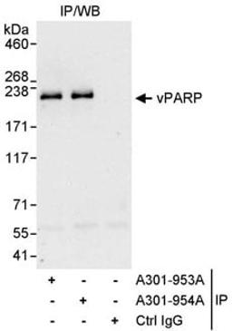 Detection of human vPARP by western blot of immunoprecipitates.