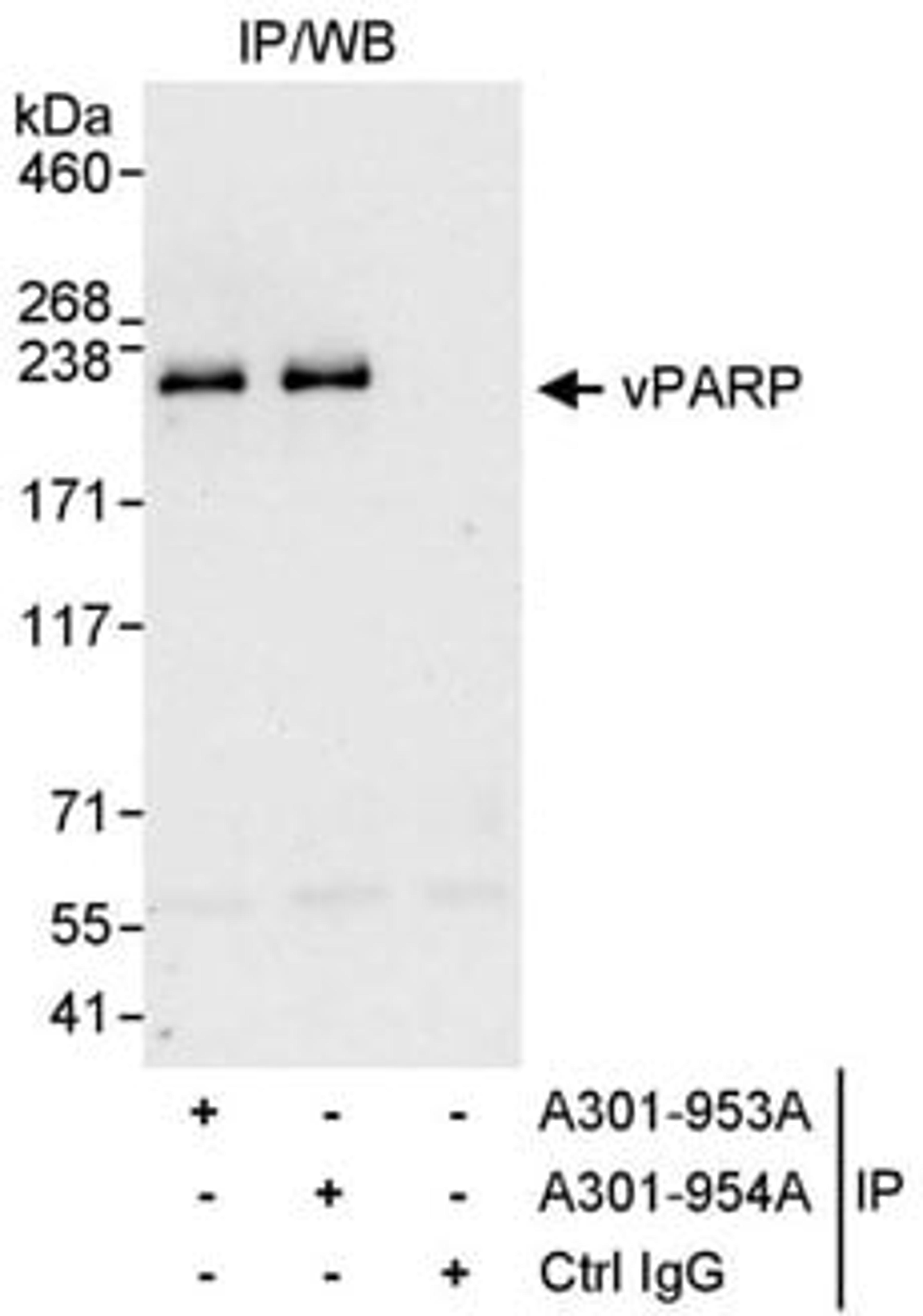 Detection of human vPARP by western blot of immunoprecipitates.