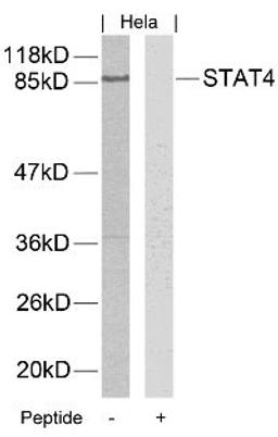 Western blot analysis of lysed extracts from HeLa, A431 and JK cells using STAT4 (Ab-693).