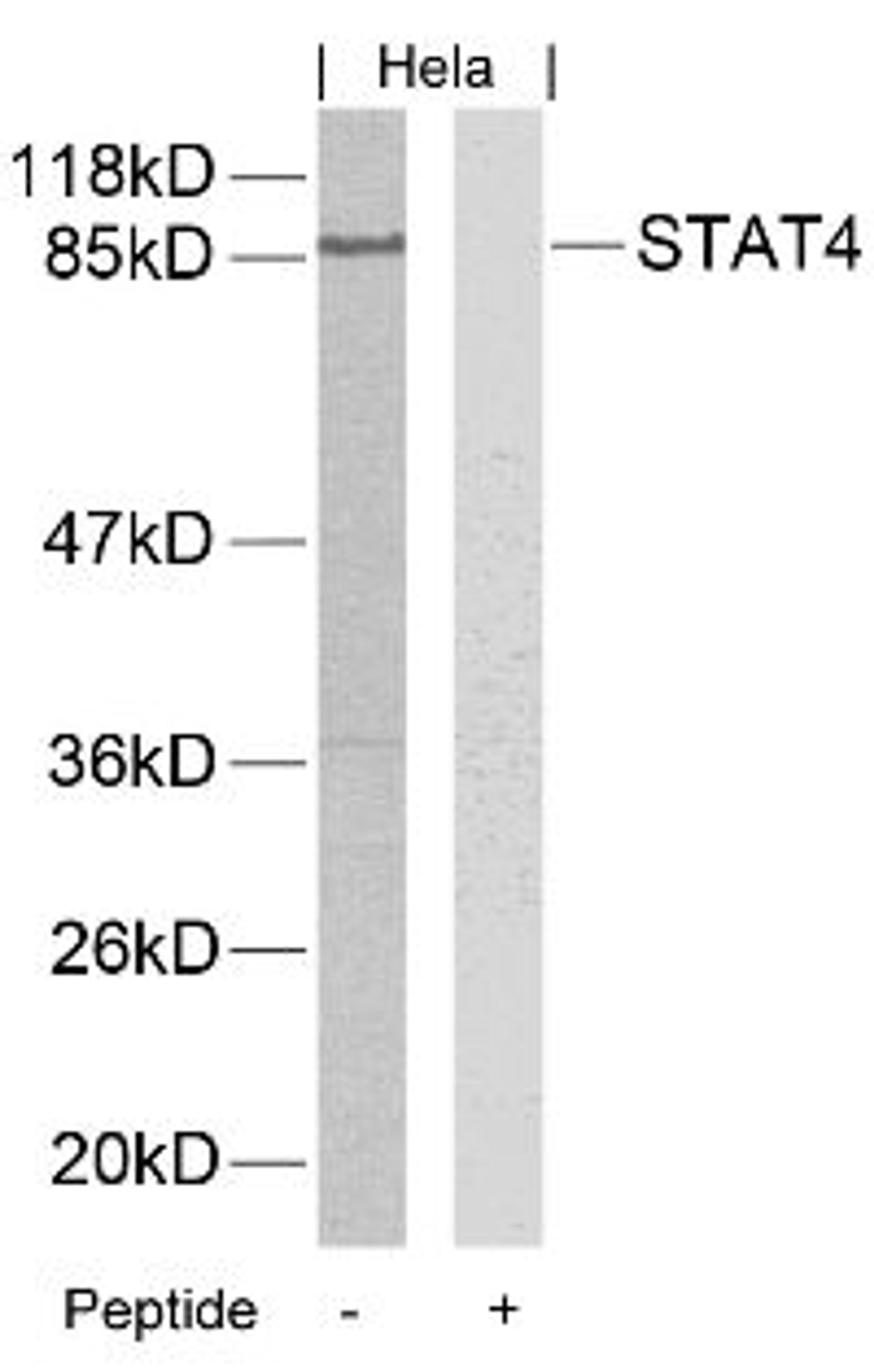 Western blot analysis of lysed extracts from HeLa, A431 and JK cells using STAT4 (Ab-693).