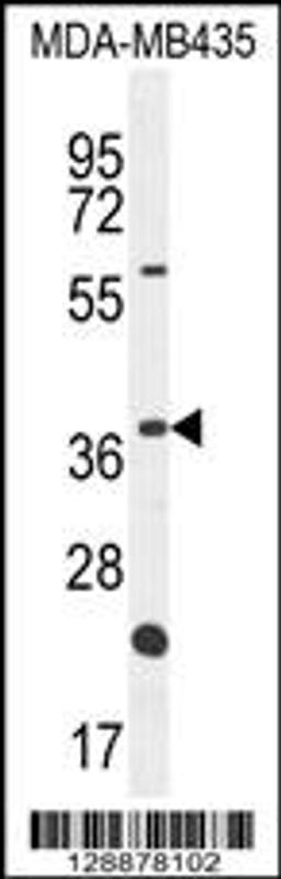 Western blot analysis in MDA-MB435 cell line lysates (35ug/lane).