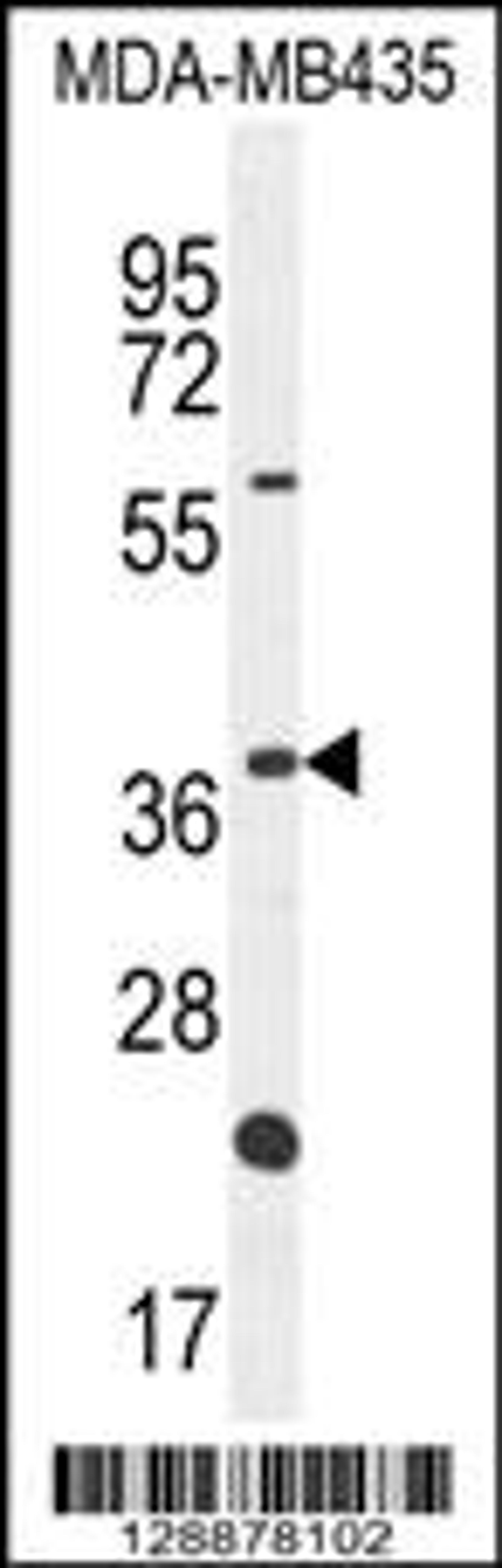 Western blot analysis in MDA-MB435 cell line lysates (35ug/lane).