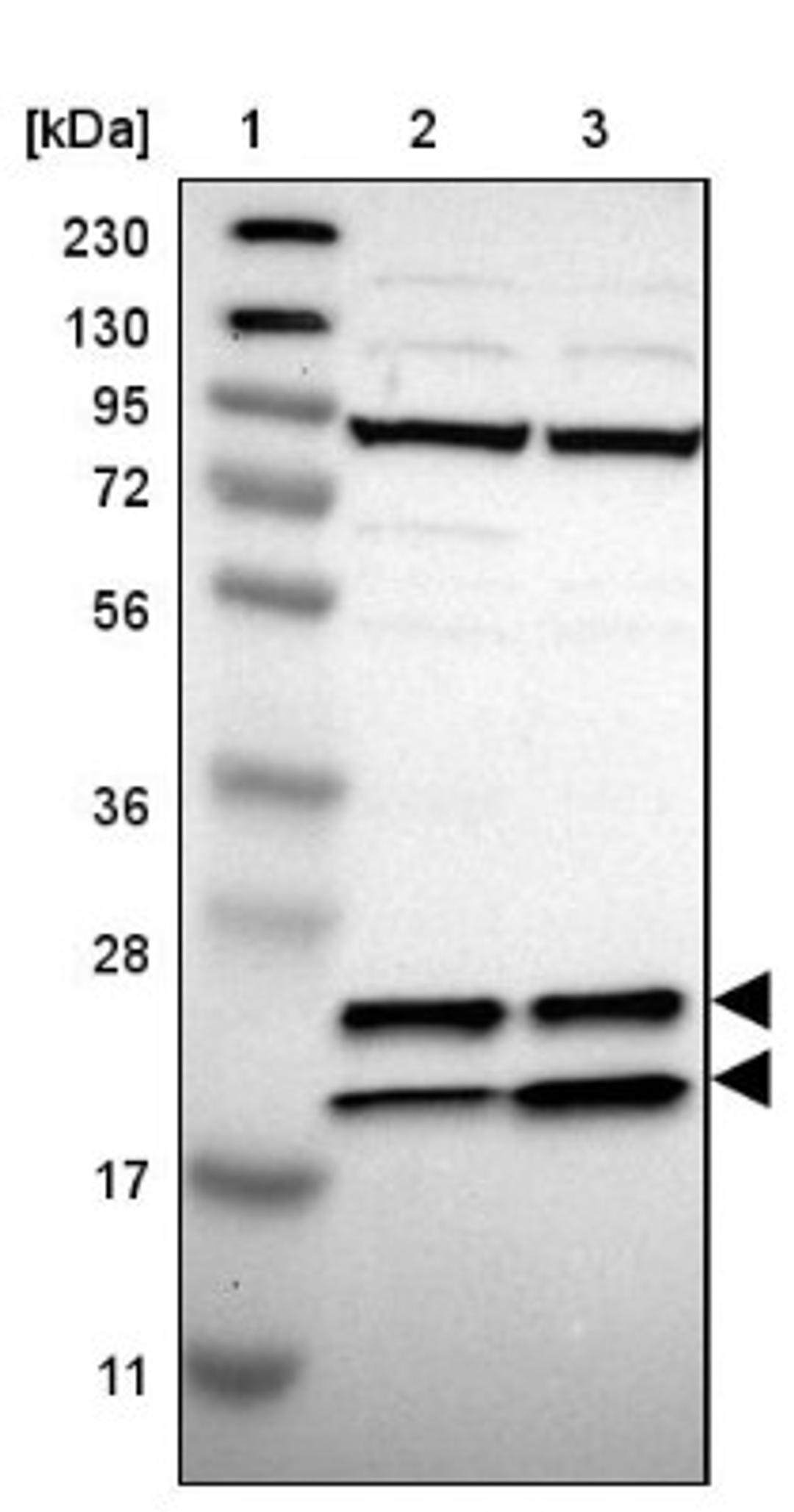 Western Blot: SSR3 Antibody [NBP1-80667] - Lane 1: Marker [kDa] 230, 130, 95, 72, 56, 36, 28, 17, 11<br/>Lane 2: Human cell line RT-4<br/>Lane 3: Human cell line U-251MG sp