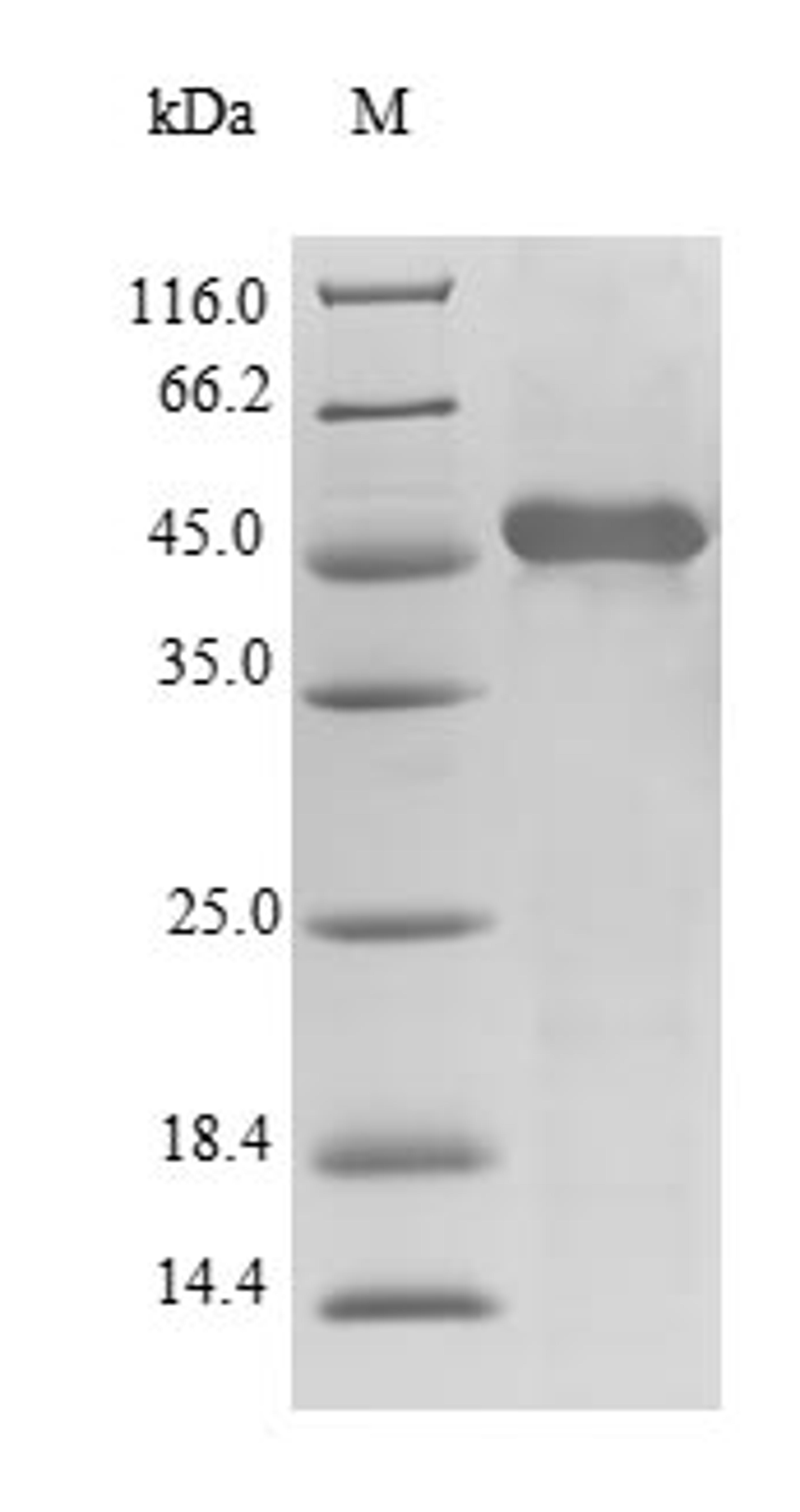 (Tris-Glycine gel) Discontinuous SDS-PAGE (reduced) with 5% enrichment gel and 15% separation gel.