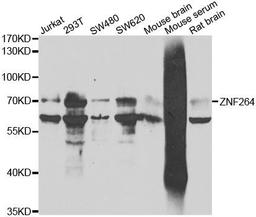 Western blot analysis of extracts of various cell lines using ZNF264 antibody