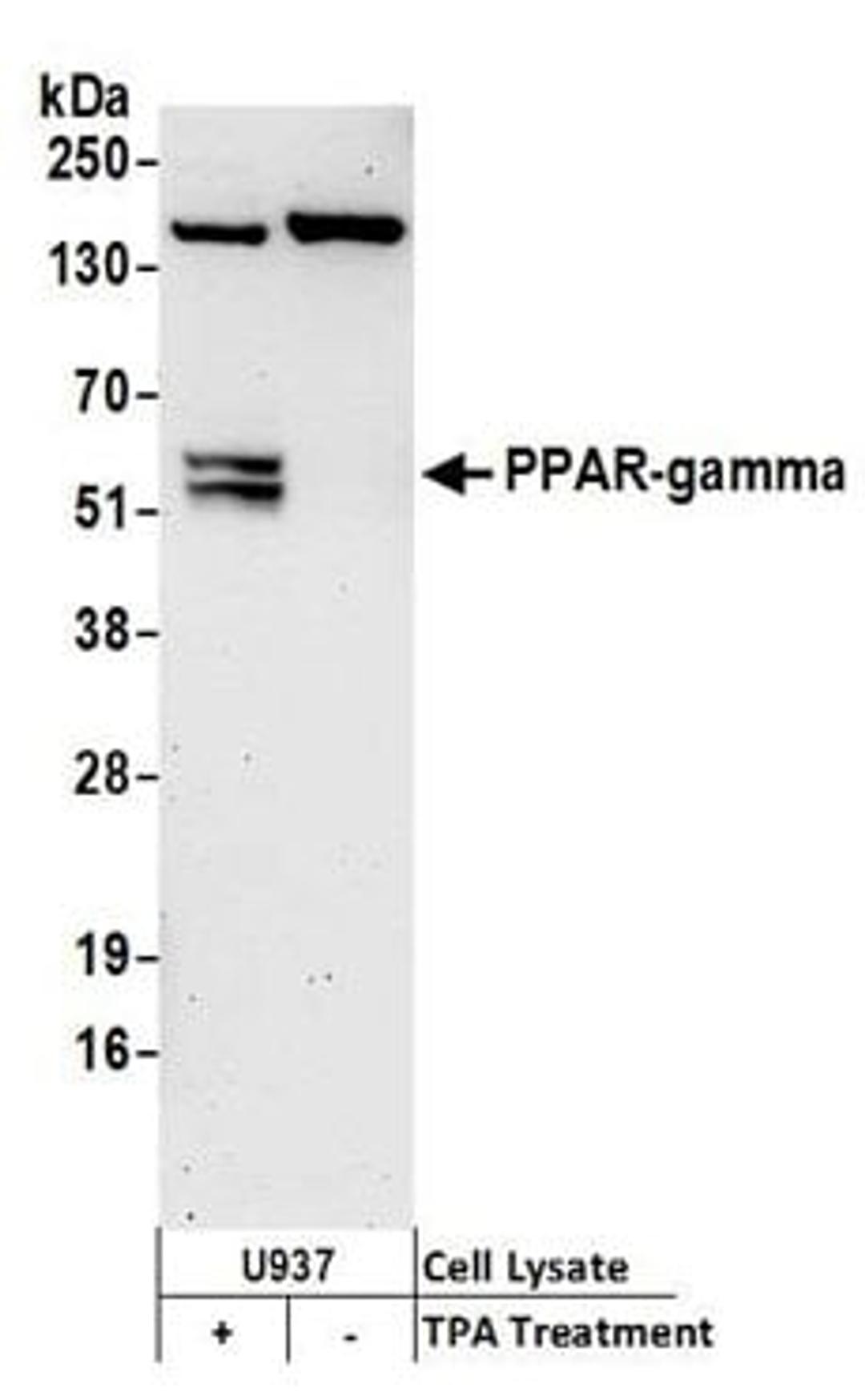 Detection of human PPAR-gamma by western blot.