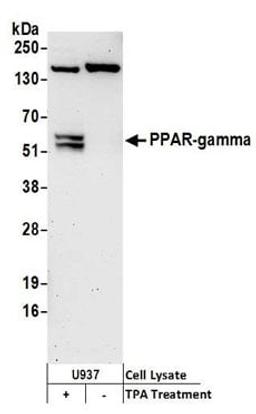 Detection of human PPAR-gamma by western blot.