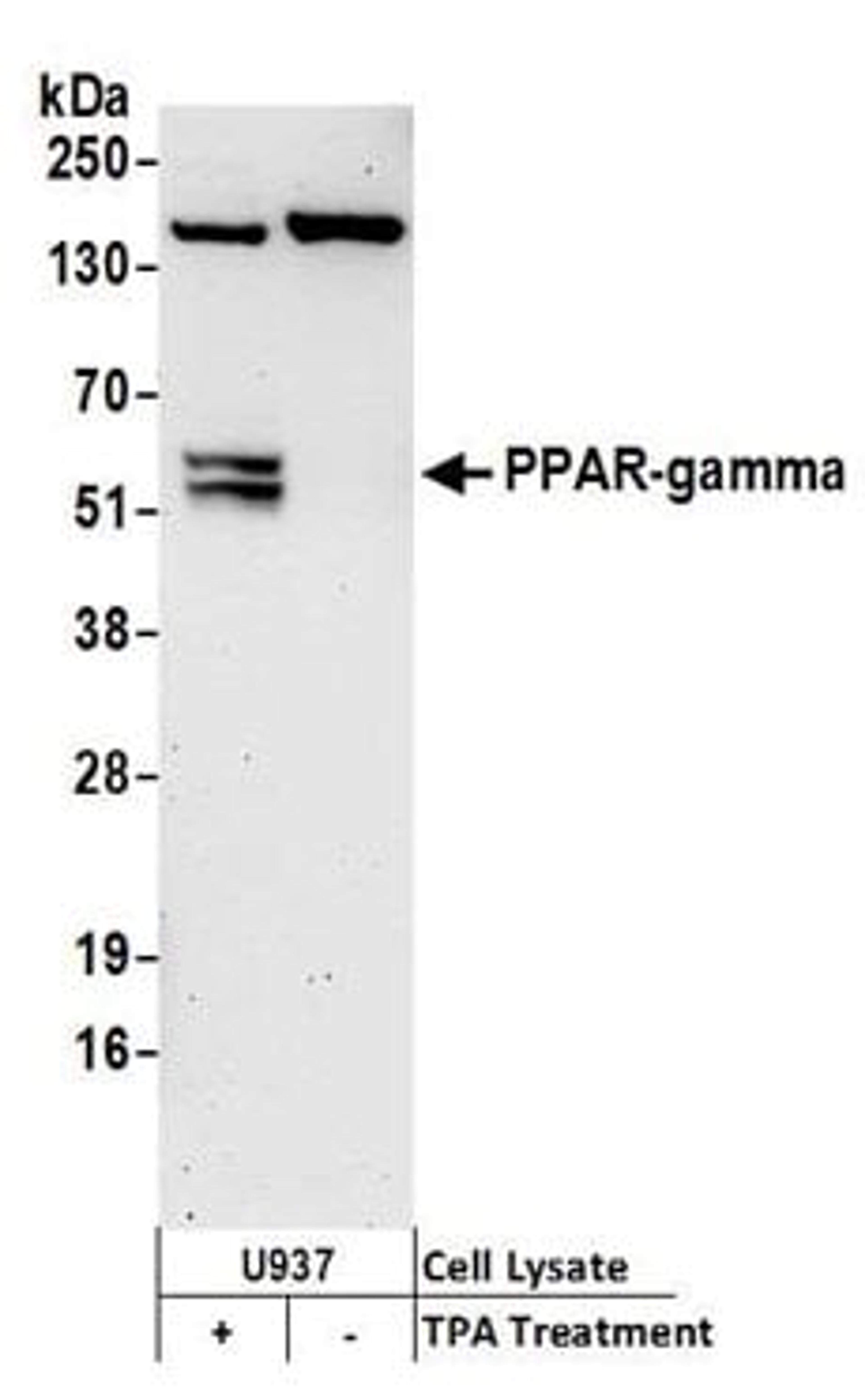 Detection of human PPAR-gamma by western blot.