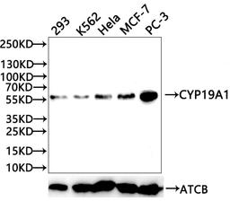 Western Blot. Positive WB detected in: HepG2 whole cell lysate, Jurkat whole cell lysate, 293 whole cell lysate, SH-SY5Y whole cell lysate, U87 whole cell lysate, K562 whole cell lysate. All lanes: CYP19A1 antibody at 2.3μg/ml. Secondary. Goat polyclonal to rabbit IgG at 1/50000 dilution. Predicted band size: 58, 25 KDa. Observed band size: 58 KDa.