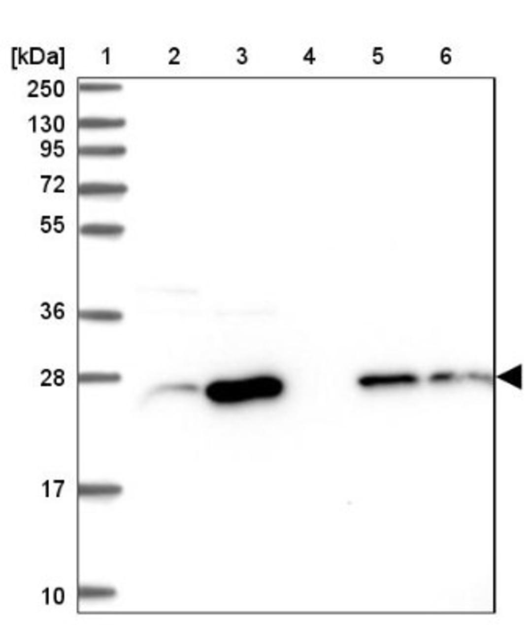 Western Blot: CRIP2 Antibody [NBP1-84379] - Lane 1: Marker [kDa] 250, 130, 95, 72, 55, 36, 28, 17, 10<br/>Lane 2: Human cell line RT-4<br/>Lane 3: Human cell line U-251MG sp<br/>Lane 4: Human plasma (IgG/HSA depleted)<br/>Lane 5: Human liver tissue<br/>Lane 6: Human tonsil tissue