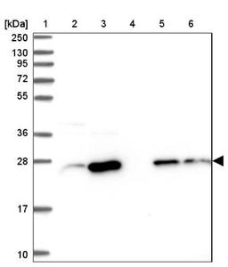 Western Blot: CRIP2 Antibody [NBP1-84379] - Lane 1: Marker [kDa] 250, 130, 95, 72, 55, 36, 28, 17, 10<br/>Lane 2: Human cell line RT-4<br/>Lane 3: Human cell line U-251MG sp<br/>Lane 4: Human plasma (IgG/HSA depleted)<br/>Lane 5: Human liver tissue<br/>Lane 6: Human tonsil tissue