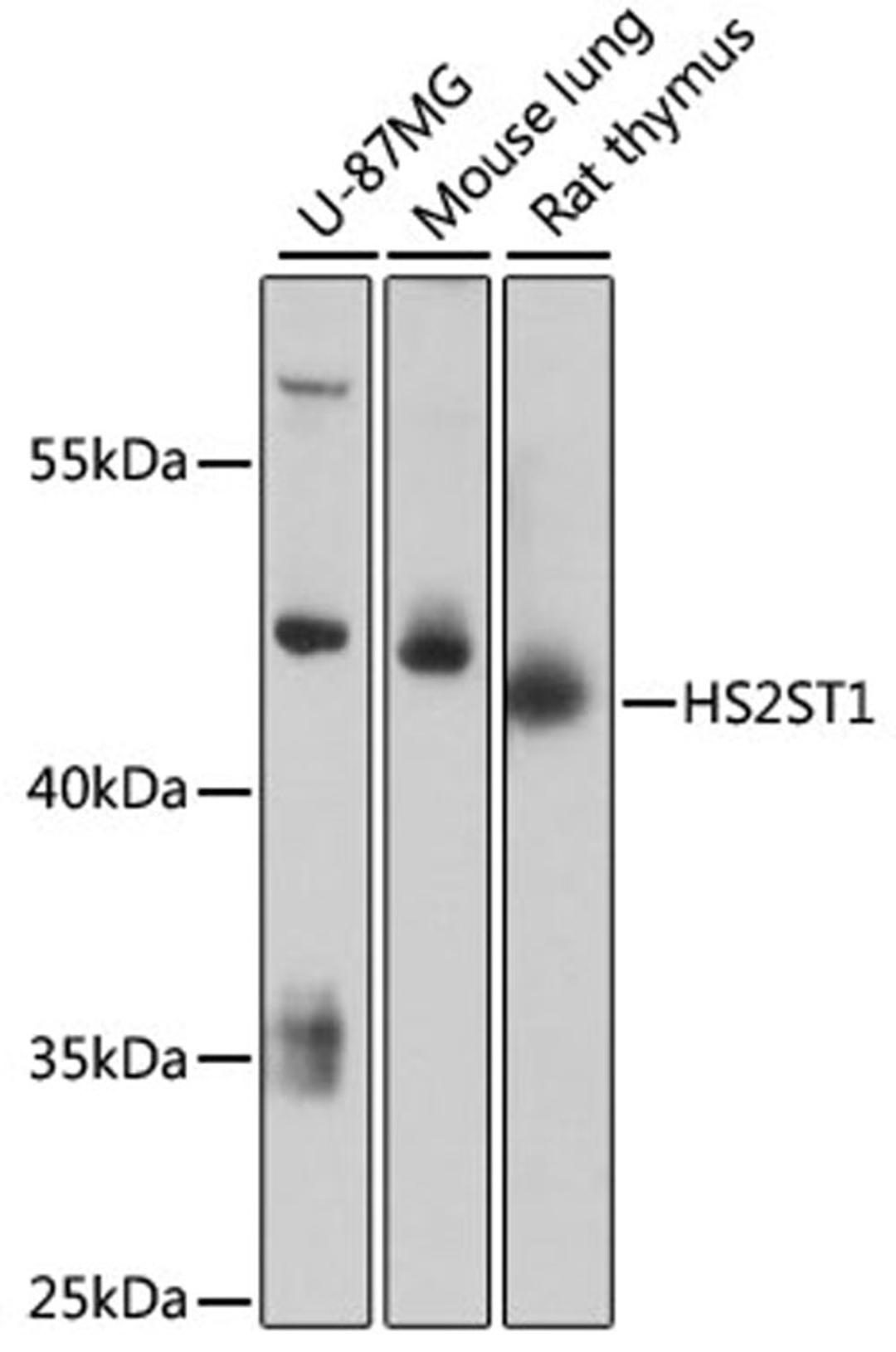 Western blot - HS2ST1 antibody (A13837)