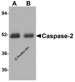 Western blot analysis of Caspase-2 in (A) human thymus tissue and (B) human kidney lysate with Caspase-2 antibody at 1 μg/mL.