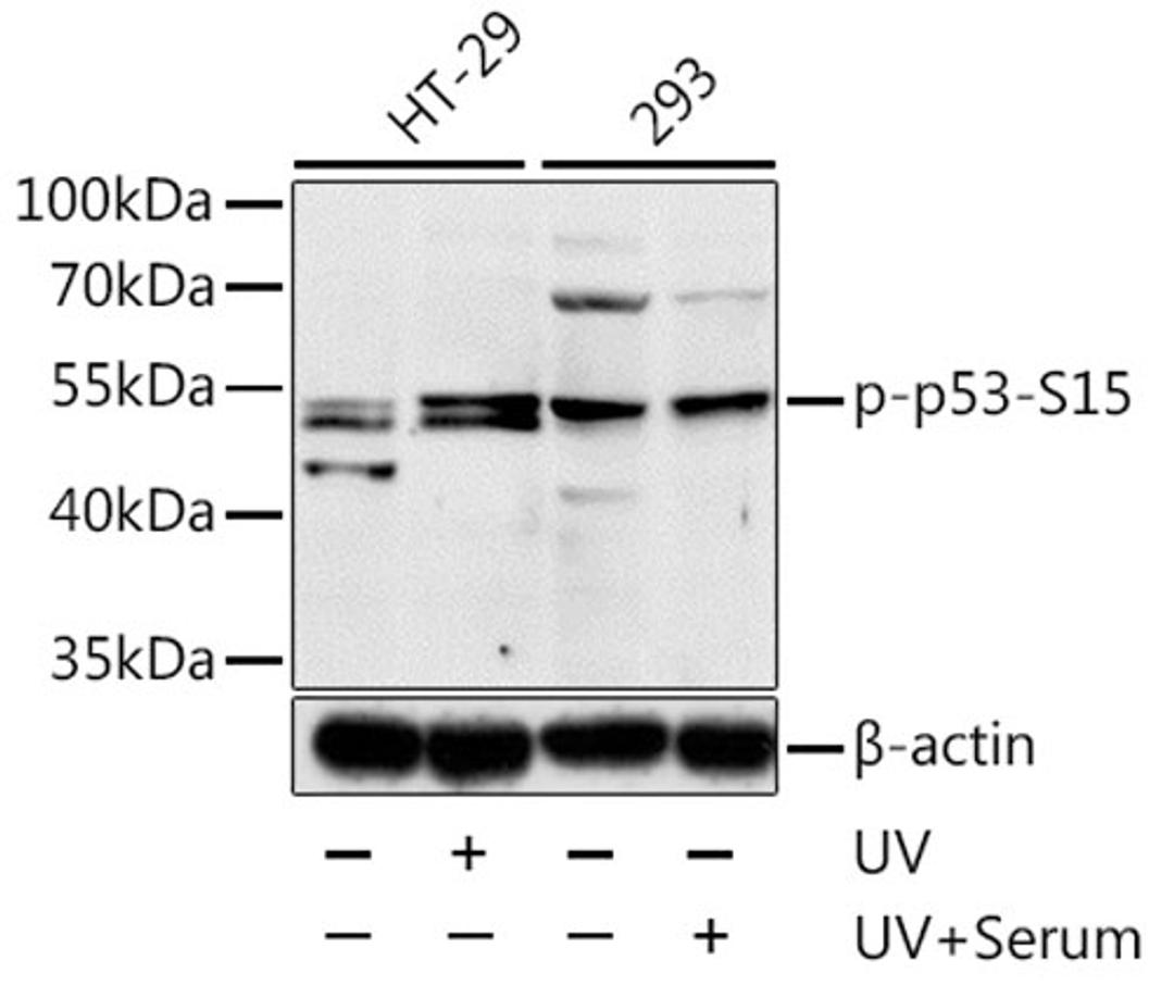 Western blot - Phospho-p53-S15 antibody (AP0083)