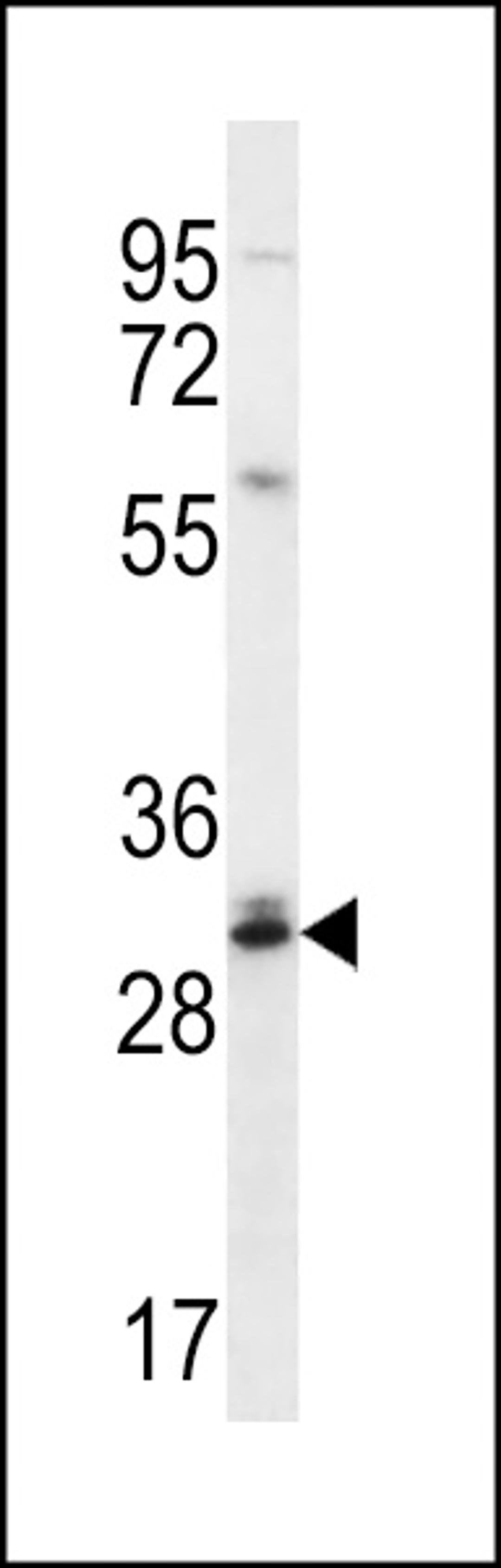 Western blot analysis in Jurkat cell line lysates (35ug/lane).