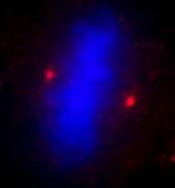 Detection of human ALMS1 by immunocytochemistry.